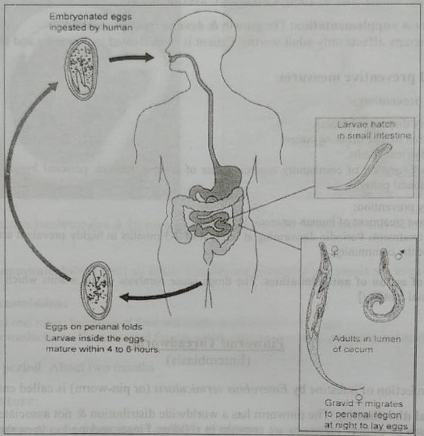 Definition of Pinworm