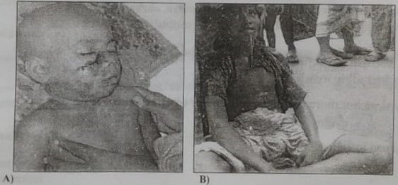 Definition of Rabies