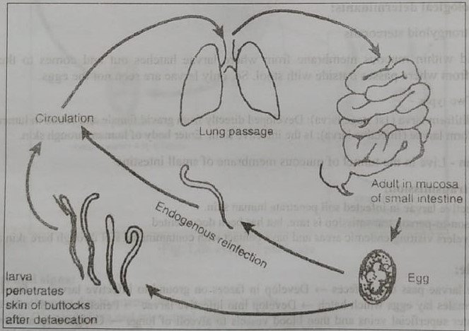 Definition of Strongyloidiasis