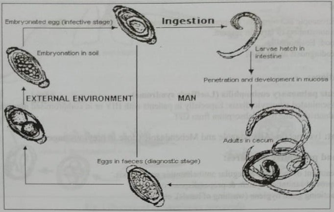 Definition of Trichuriasis