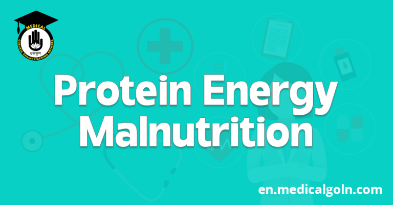 Protein Energy Malnutrition