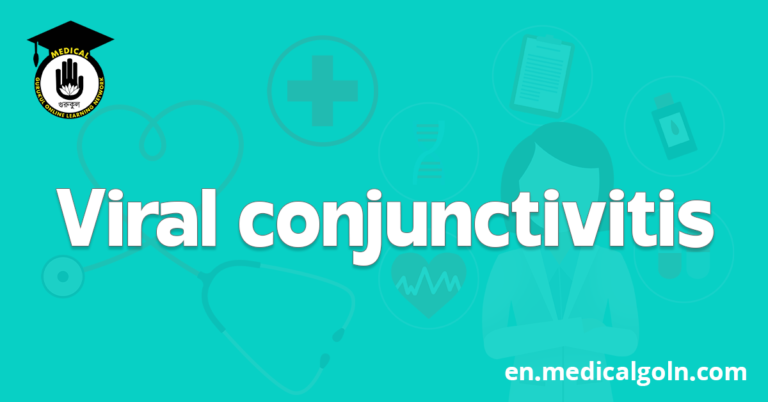 Viral conjunctivitis